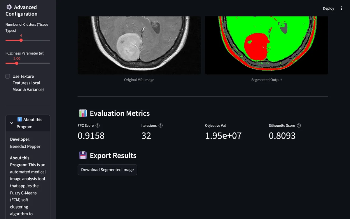 Brain Tumor FCM Segmentation screenshot 3