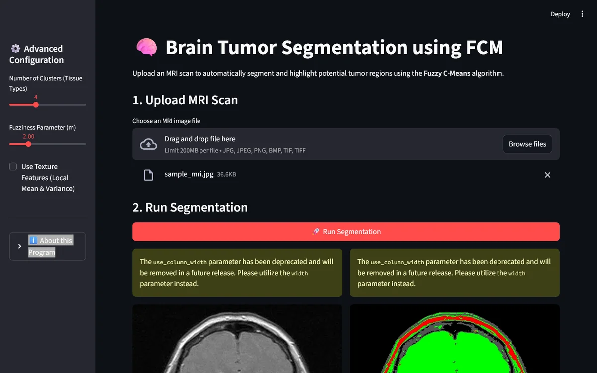 Brain Tumor FCM Segmentation screenshot 1