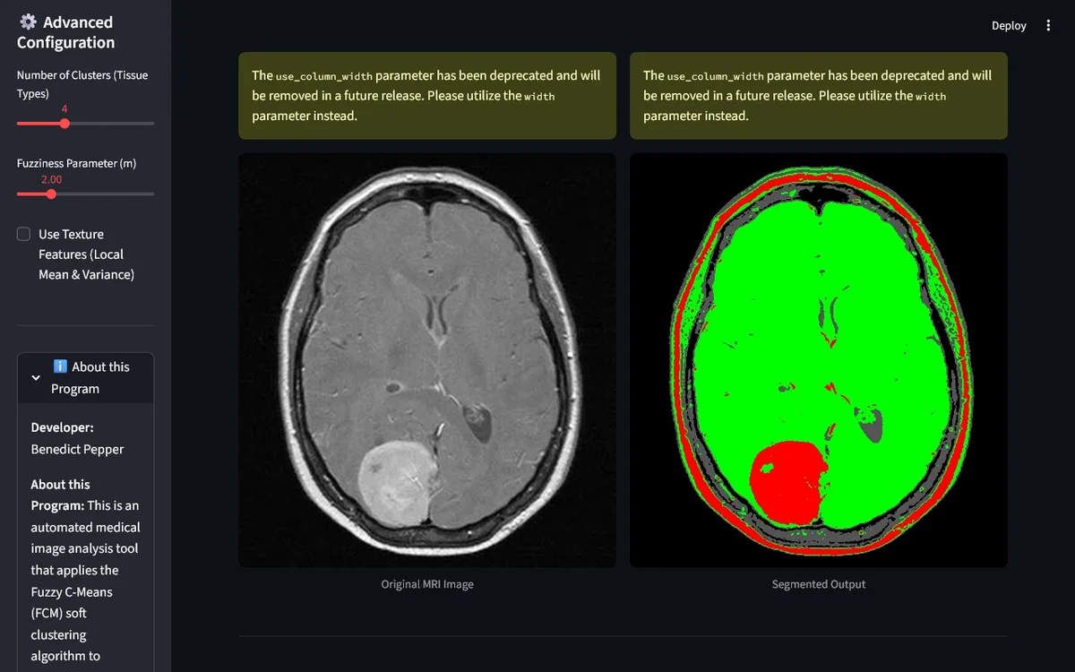 Brain Tumor FCM Segmentation screenshot 2