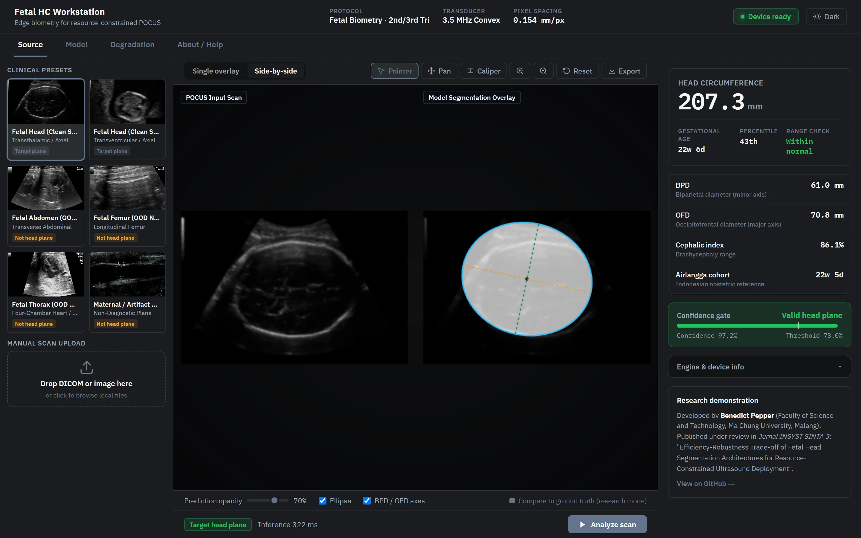 Fetal Head Ultrasound Segmentation screenshot 2