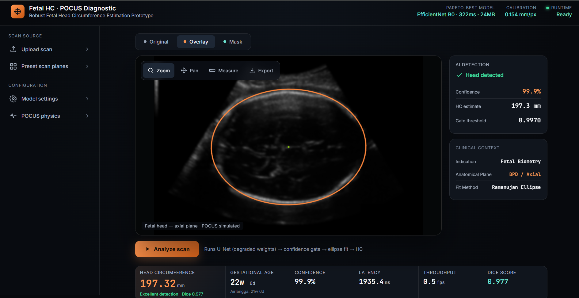 Fetal Head Ultrasound Segmentation screenshot 1