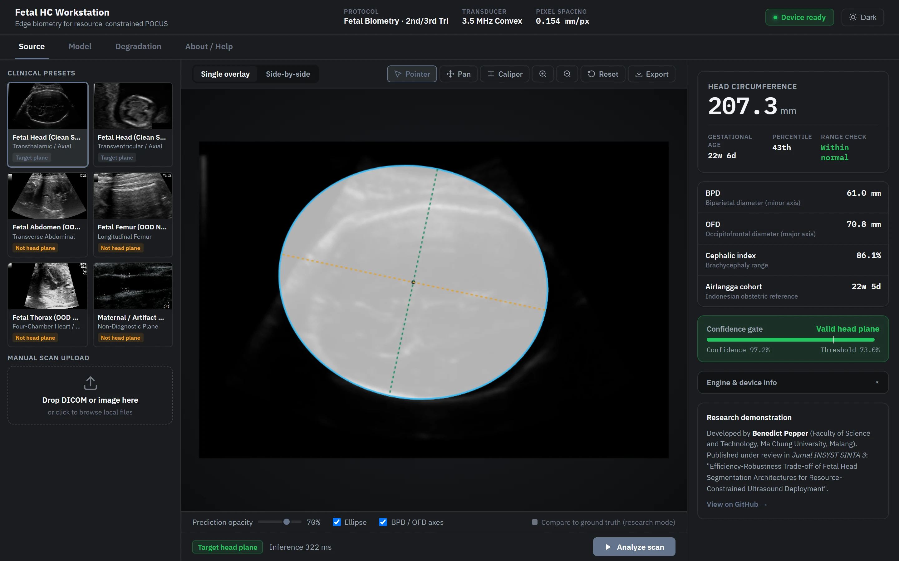 Fetal Head Ultrasound Segmentation screenshot 1