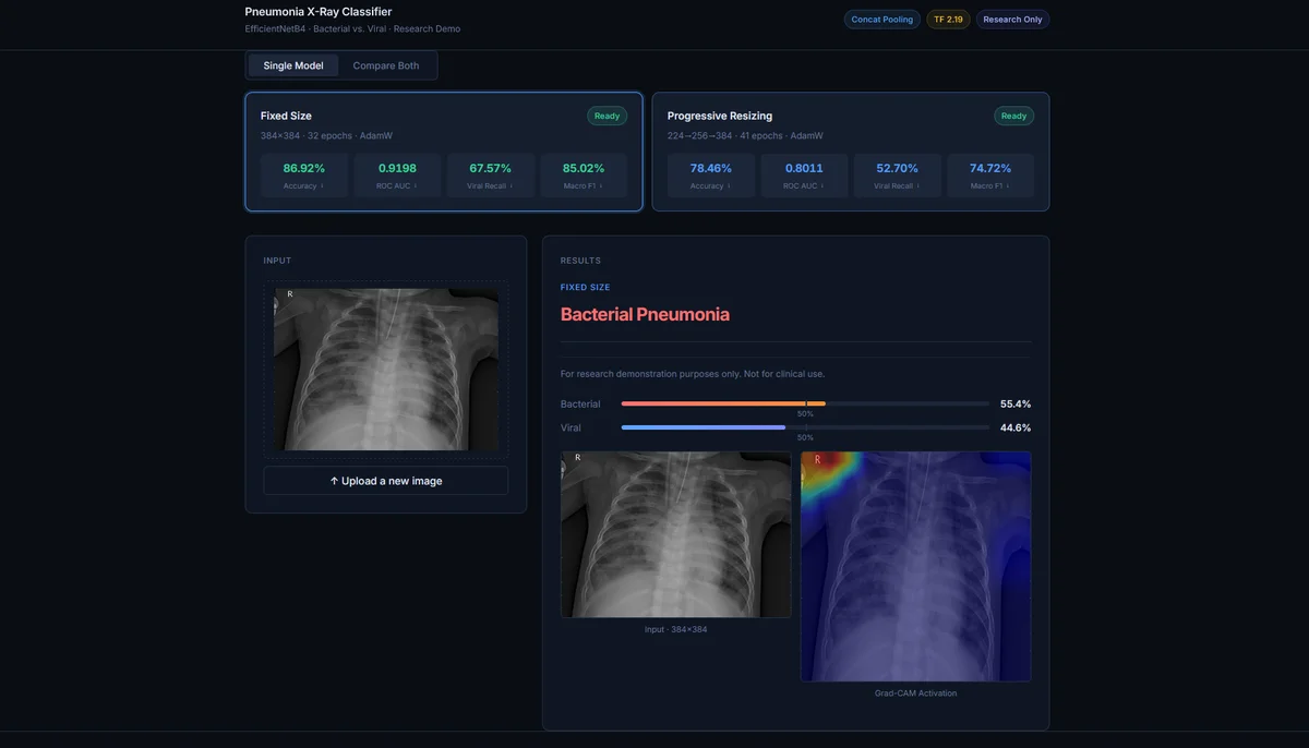 Pneumonia Classifier screenshot 1