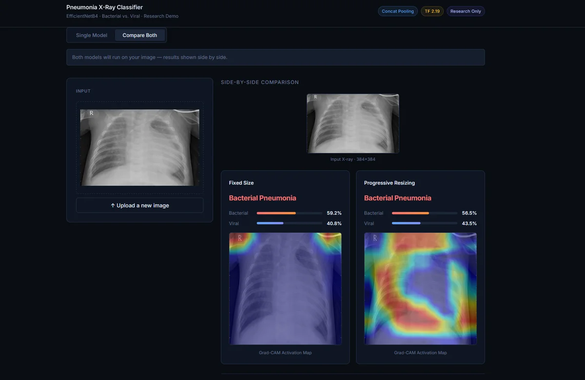 Pneumonia Classifier screenshot 2
